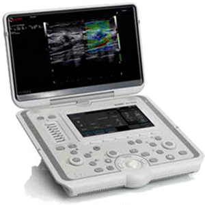 Mobile Ultrasound Machine